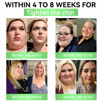 🧬 Alcuras™ Moringa + Berberine AMPK Slimming Patch